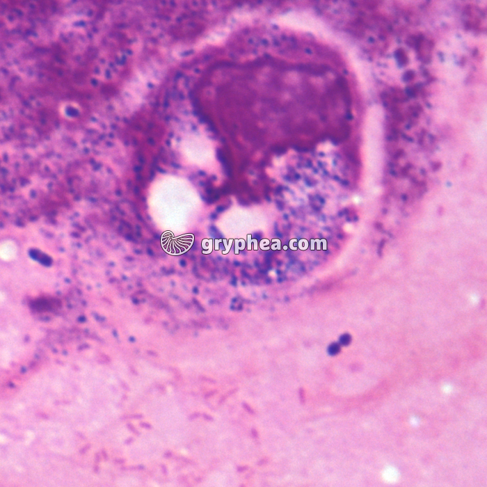 Phagocytose x1000 - gryphea.org